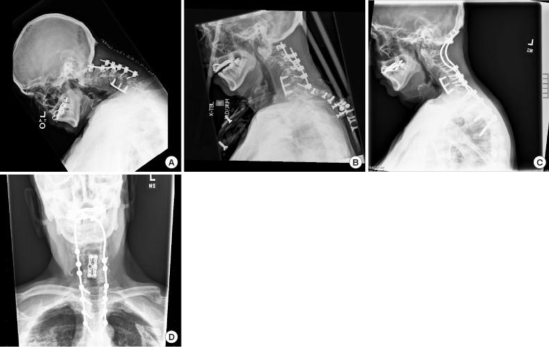 https://cdn.ncbi.nlm.nih.gov/pmc/blobs/77cd/6790735/2123b4cc980d/ns-1938288-144f8.jpg