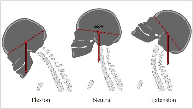 https://cdn.ncbi.nlm.nih.gov/pmc/blobs/77cd/6790735/339832387195/ns-1938288-144f1.jpg