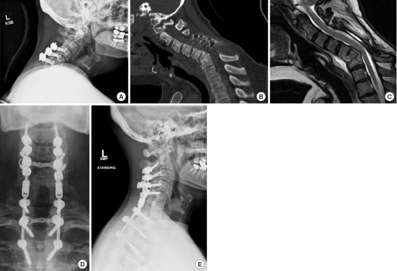 https://cdn.ncbi.nlm.nih.gov/pmc/blobs/77cd/6790735/45b64f63f3f9/ns-1938288-144f10.jpg