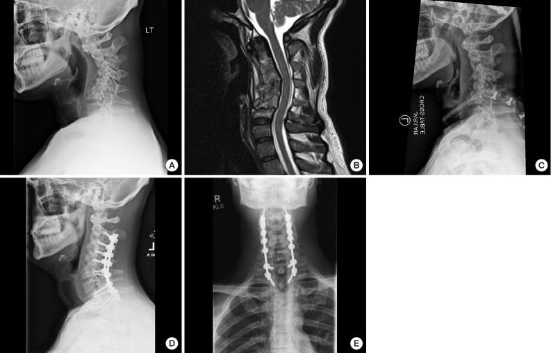 https://cdn.ncbi.nlm.nih.gov/pmc/blobs/77cd/6790735/58251282a5c3/ns-1938288-144f7.jpg