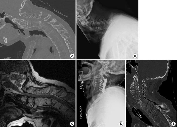 https://cdn.ncbi.nlm.nih.gov/pmc/blobs/77cd/6790735/6000860ad0d8/ns-1938288-144f9.jpg