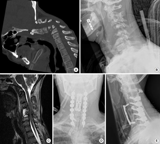 https://cdn.ncbi.nlm.nih.gov/pmc/blobs/77cd/6790735/9a492b51909f/ns-1938288-144f6.jpg