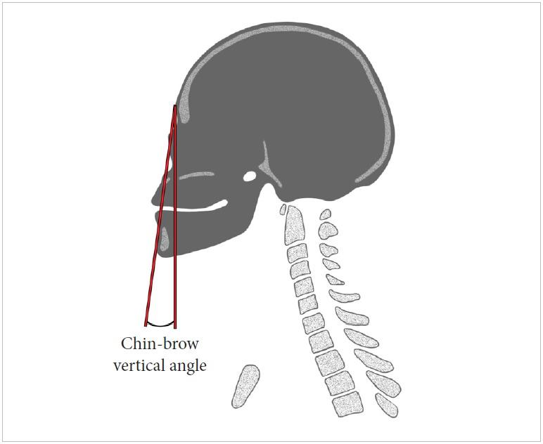 https://cdn.ncbi.nlm.nih.gov/pmc/blobs/77cd/6790735/a74962f8aa57/ns-1938288-144f3.jpg