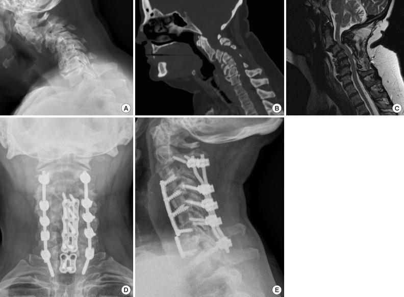 https://cdn.ncbi.nlm.nih.gov/pmc/blobs/77cd/6790735/cb67e9f9da08/ns-1938288-144f5.jpg