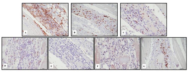 https://cdn.ncbi.nlm.nih.gov/pmc/blobs/77d2/10342066/504eb71c664e/ijms-24-10919-g007.jpg