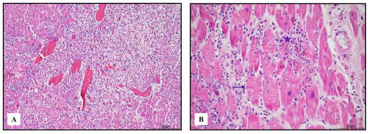 https://cdn.ncbi.nlm.nih.gov/pmc/blobs/77d2/10342066/5f0b14c76435/ijms-24-10919-g001.jpg