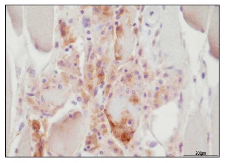 https://cdn.ncbi.nlm.nih.gov/pmc/blobs/77d2/10342066/725525b0e98d/ijms-24-10919-g008.jpg