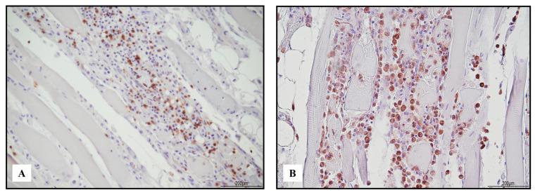 https://cdn.ncbi.nlm.nih.gov/pmc/blobs/77d2/10342066/99416a1356ef/ijms-24-10919-g006.jpg