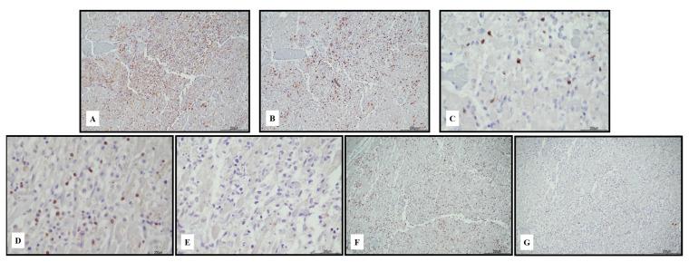 https://cdn.ncbi.nlm.nih.gov/pmc/blobs/77d2/10342066/c81ed37c6aac/ijms-24-10919-g003.jpg
