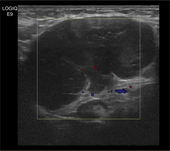 https://cdn.ncbi.nlm.nih.gov/pmc/blobs/77d2/5694202/099a92318484/ott-10-5459Fig1.jpg