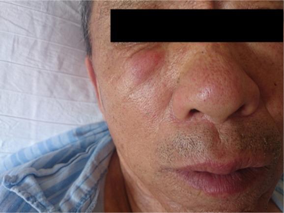https://cdn.ncbi.nlm.nih.gov/pmc/blobs/77d2/5694202/1eca88a6e0ab/ott-10-5459Fig3.jpg