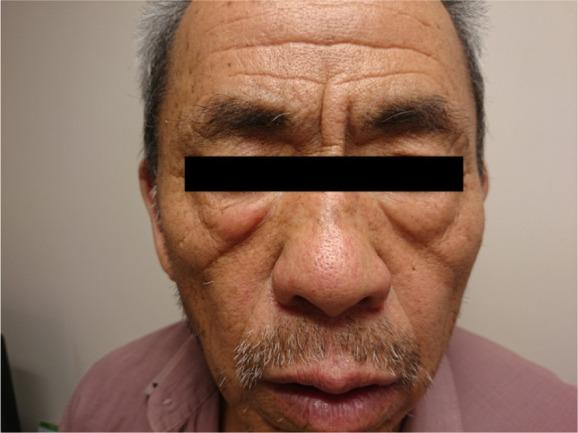 https://cdn.ncbi.nlm.nih.gov/pmc/blobs/77d2/5694202/330e75a2703f/ott-10-5459Fig5.jpg