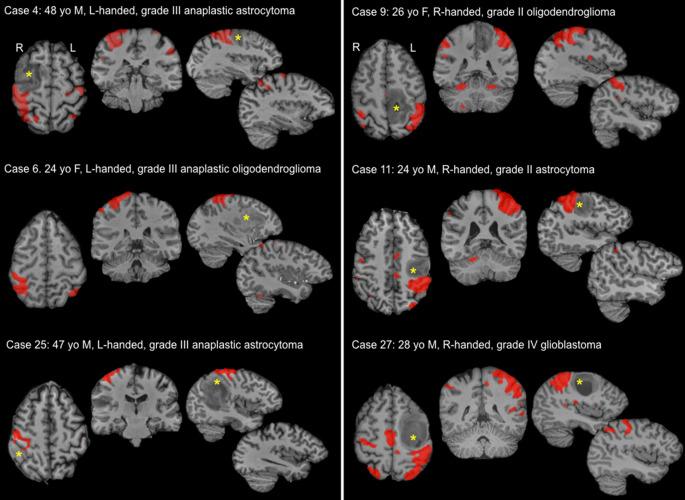 https://cdn.ncbi.nlm.nih.gov/pmc/blobs/77d3/7943510/081cef1477e9/62_2020_879_Fig3_HTML.jpg