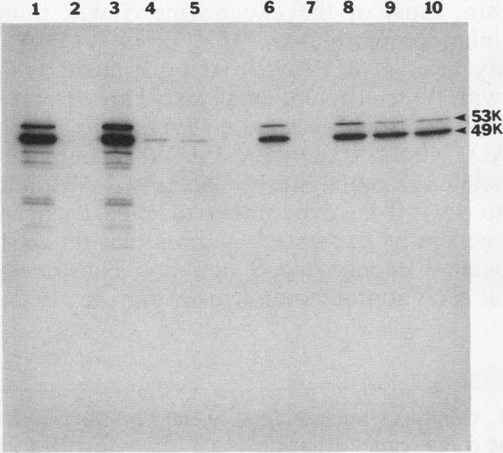 https://cdn.ncbi.nlm.nih.gov/pmc/blobs/77dc/208981/bc3b43062bf6/jbacter01038-0159-a.jpg