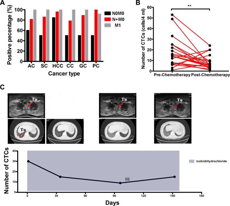 https://cdn.ncbi.nlm.nih.gov/pmc/blobs/77dd/5129969/f77c86717b11/oncotarget-07-39768-g006a.jpg