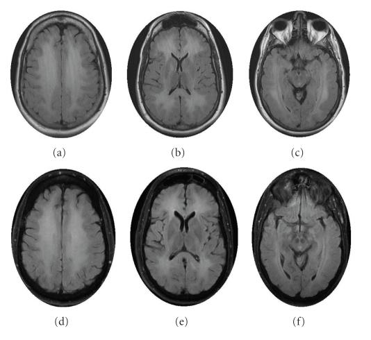https://cdn.ncbi.nlm.nih.gov/pmc/blobs/77e1/3014830/c2bb20a206ef/CRIM2010-716494.001.jpg