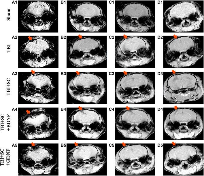 https://cdn.ncbi.nlm.nih.gov/pmc/blobs/77e8/9453866/a0fd85777b0e/fbioe-10-895406-g007.jpg