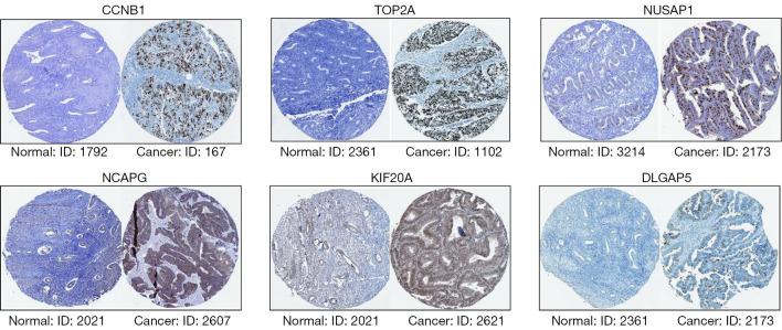 https://cdn.ncbi.nlm.nih.gov/pmc/blobs/77e9/9273707/be864693caac/tcr-11-06-1630-f6.jpg