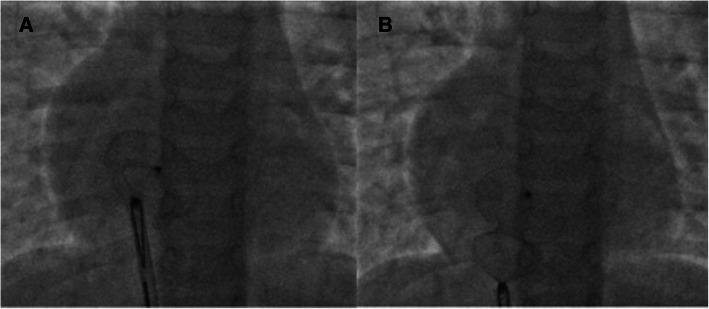 https://cdn.ncbi.nlm.nih.gov/pmc/blobs/77ea/8179878/3645610994a4/43044_2021_175_Fig6_HTML.jpg