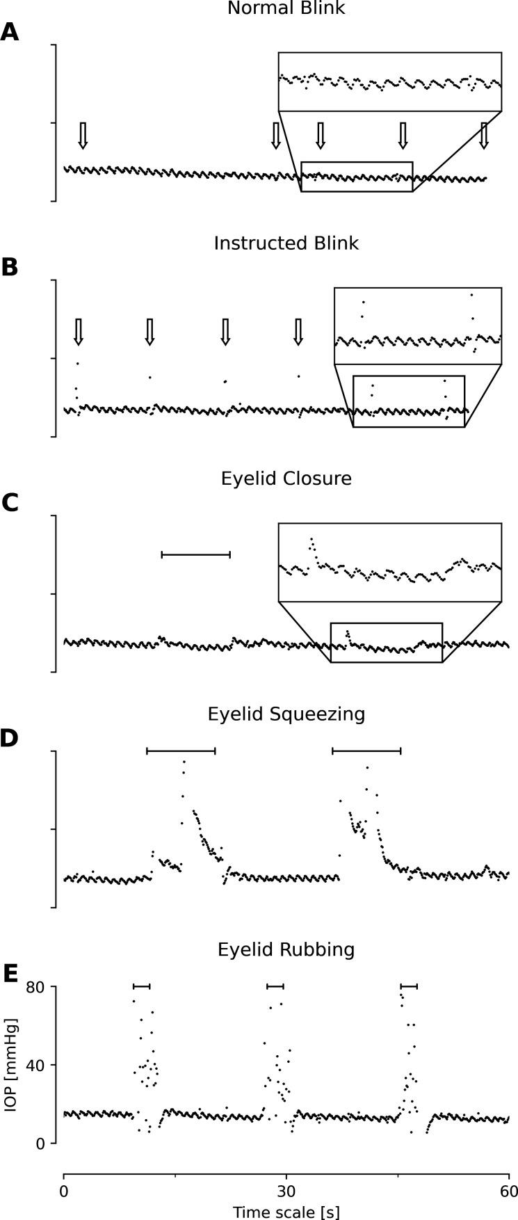 https://cdn.ncbi.nlm.nih.gov/pmc/blobs/77ee/10579178/7df250f540d3/bjophthalmol-2021-320508f01.jpg