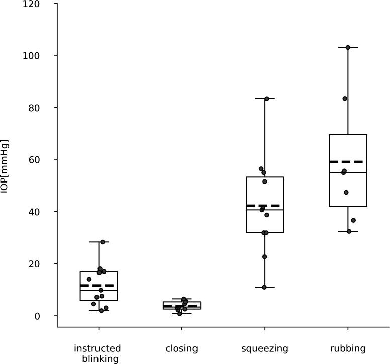 https://cdn.ncbi.nlm.nih.gov/pmc/blobs/77ee/10579178/93bee426793b/bjophthalmol-2021-320508f02.jpg