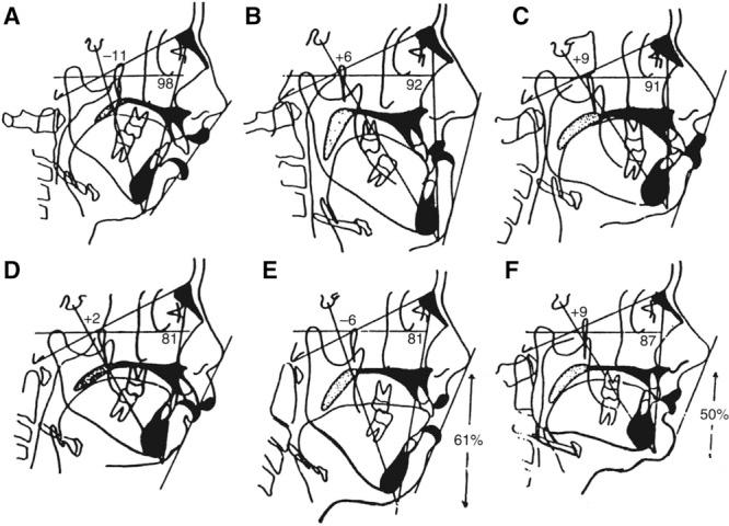https://cdn.ncbi.nlm.nih.gov/pmc/blobs/77f2/4995693/1ccf2a88fbab/gox-4-e705-g001.jpg