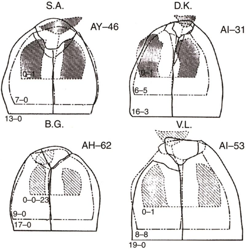 https://cdn.ncbi.nlm.nih.gov/pmc/blobs/77f2/4995693/209e43869f21/gox-4-e705-g007.jpg
