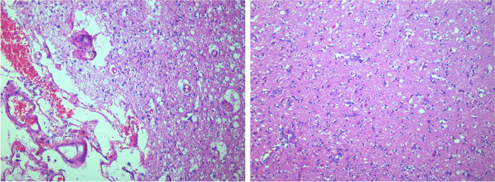 https://cdn.ncbi.nlm.nih.gov/pmc/blobs/77fa/9585841/6c2b147e122a/13256_2022_3500_Fig5_HTML.jpg