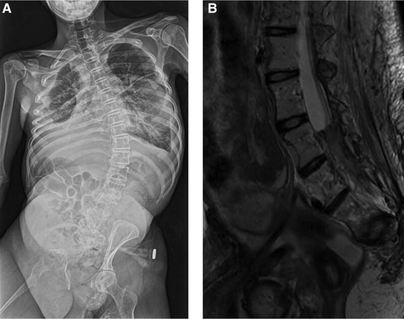 https://cdn.ncbi.nlm.nih.gov/pmc/blobs/77fb/10238027/5dc9e9d9887a/medi-102-e33950-g001.jpg