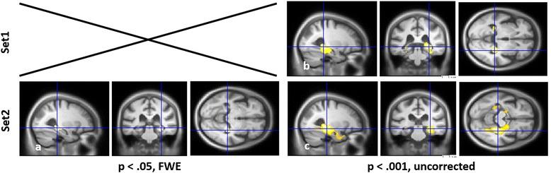 https://cdn.ncbi.nlm.nih.gov/pmc/blobs/7803/4967326/3e5602c2ebf7/13195_2016_190_Fig3_HTML.jpg