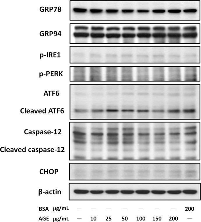 https://cdn.ncbi.nlm.nih.gov/pmc/blobs/780c/4405342/726d36eccb06/pone.0124418.g004.jpg