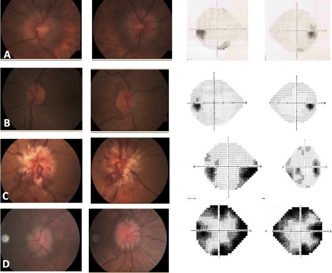 https://cdn.ncbi.nlm.nih.gov/pmc/blobs/780f/12060292/b2202e0f679d/12886_2025_3935_Fig2_HTML.jpg
