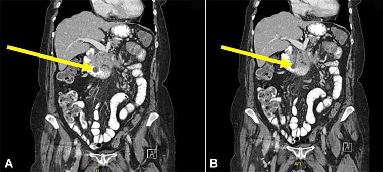 https://cdn.ncbi.nlm.nih.gov/pmc/blobs/7815/7859545/17fd5582cfd0/gr2.jpg