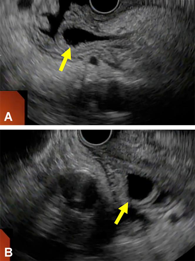 https://cdn.ncbi.nlm.nih.gov/pmc/blobs/7815/7859545/88c0326888d2/gr4.jpg