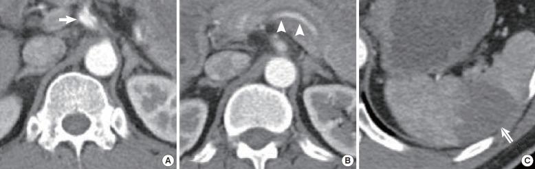 https://cdn.ncbi.nlm.nih.gov/pmc/blobs/782c/5052905/59463b648a97/ceem-15-030f2.jpg