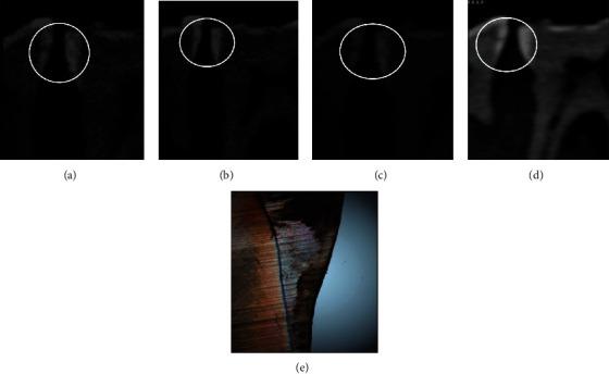 https://cdn.ncbi.nlm.nih.gov/pmc/blobs/782c/8384543/95c1757ee77c/SCANNING2021-2679012.003.jpg