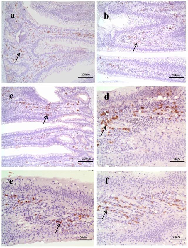 https://cdn.ncbi.nlm.nih.gov/pmc/blobs/782d/5701917/61d05578dbb4/fimmu-08-01592-g004.jpg