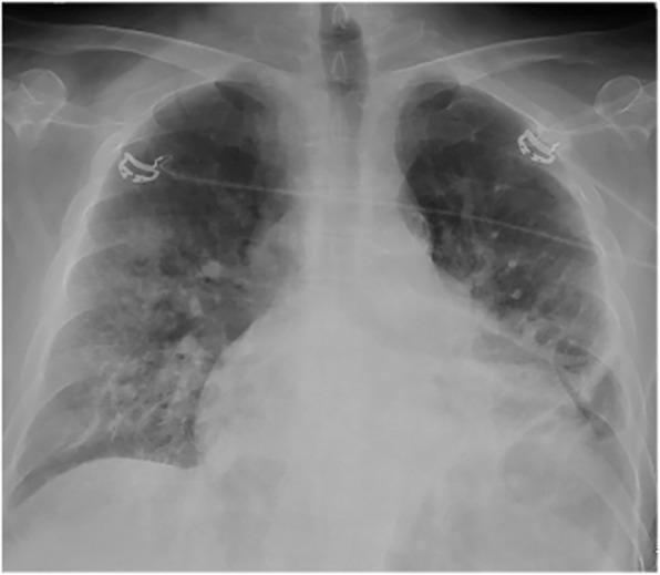 https://cdn.ncbi.nlm.nih.gov/pmc/blobs/7830/7807900/bf560e39d716/12879_2020_5723_Fig1_HTML.jpg