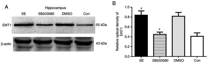 https://cdn.ncbi.nlm.nih.gov/pmc/blobs/7835/7647013/364ff3279271/MMR-22-06-5348-g05.jpg