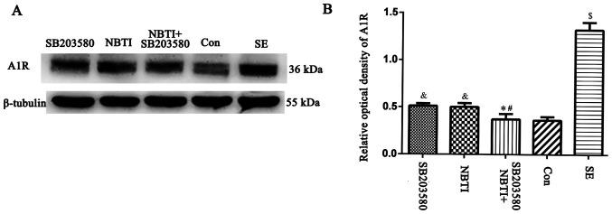 https://cdn.ncbi.nlm.nih.gov/pmc/blobs/7835/7647013/998185a3435d/MMR-22-06-5348-g07.jpg