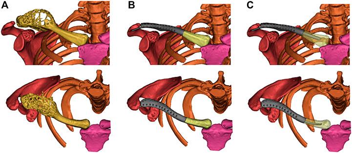 https://cdn.ncbi.nlm.nih.gov/pmc/blobs/783a/9868392/c0d7a6583c54/fbioe-10-1085674-g003.jpg