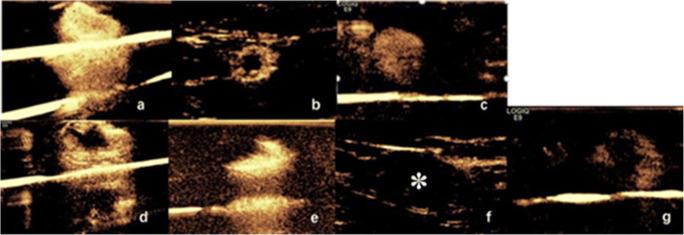 https://cdn.ncbi.nlm.nih.gov/pmc/blobs/783f/8270836/f63ead0fae47/330_2020_7639_Fig1_HTML.jpg