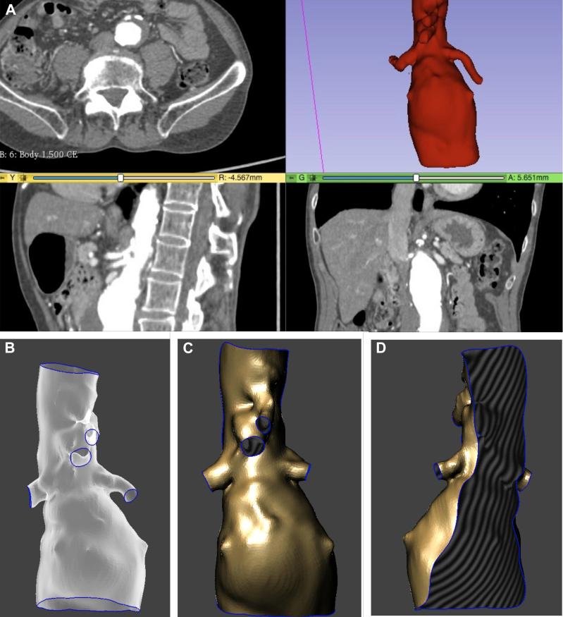 https://cdn.ncbi.nlm.nih.gov/pmc/blobs/7843/6933460/93b91391a97c/gr1.jpg