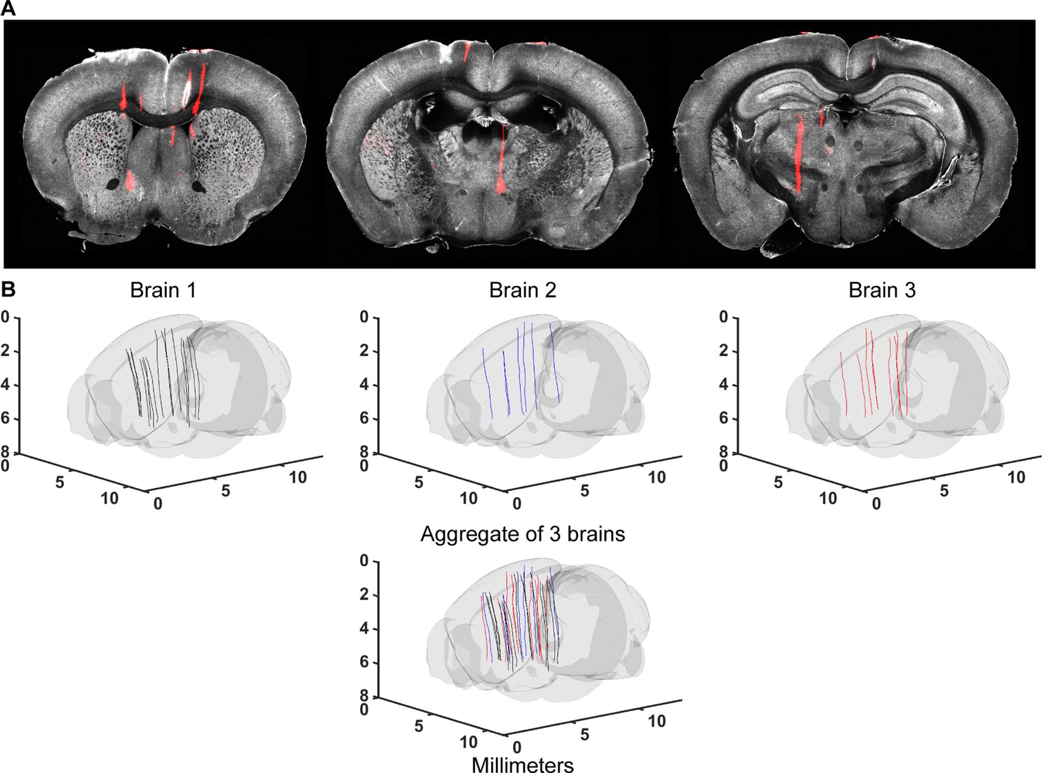 https://cdn.ncbi.nlm.nih.gov/pmc/blobs/7844/8597948/84477a959de5/ENEURO.0241-21.2021_f005.jpg