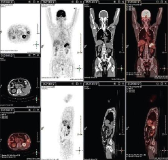 https://cdn.ncbi.nlm.nih.gov/pmc/blobs/7846/5883433/45b9596d38bf/IJNM-33-140-g001.jpg