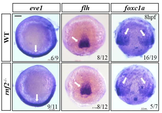 https://cdn.ncbi.nlm.nih.gov/pmc/blobs/7846/8583368/af0307a454e4/ijms-22-11368-g003.jpg