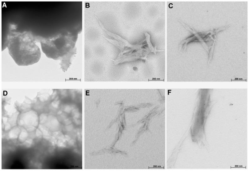 https://cdn.ncbi.nlm.nih.gov/pmc/blobs/784a/7180691/e2fa5d926001/molecules-25-01544-g006.jpg