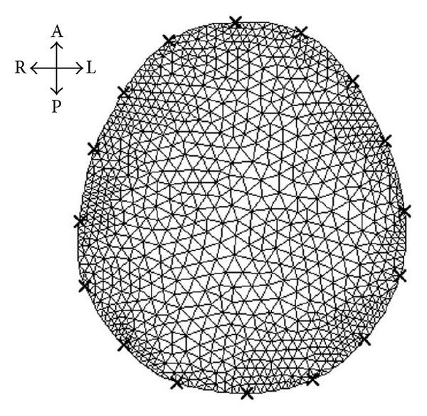https://cdn.ncbi.nlm.nih.gov/pmc/blobs/784d/4060593/c1c403b4c8c5/TSWJ2014-534012.003.jpg