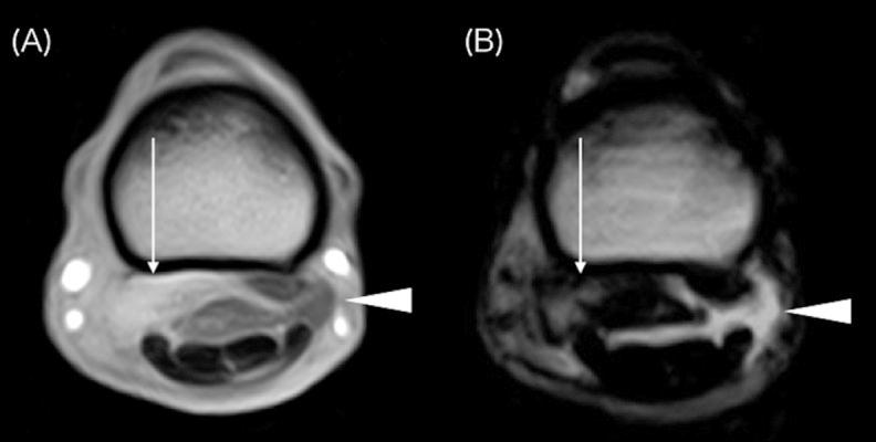 https://cdn.ncbi.nlm.nih.gov/pmc/blobs/7850/5059375/87f1f7eb95c6/jvms-78-1475-g007.jpg