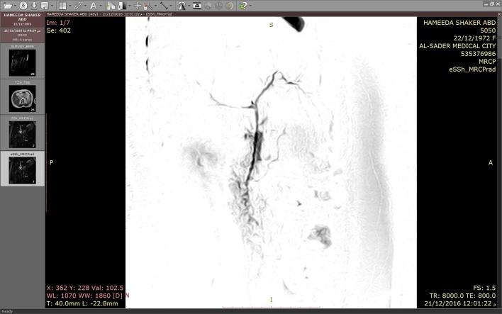 https://cdn.ncbi.nlm.nih.gov/pmc/blobs/7857/5552385/8a627fa450b2/gr4.jpg